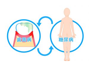 糖尿病と歯周病