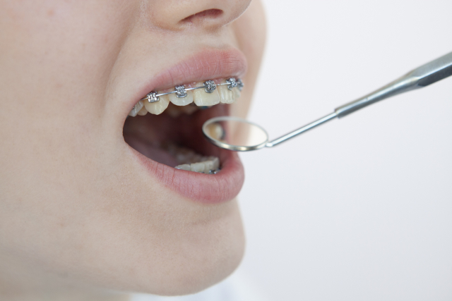 歯の矯正治療は痛い？