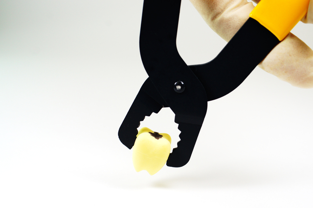 埋伏親知らずは必ず抜歯が必要？